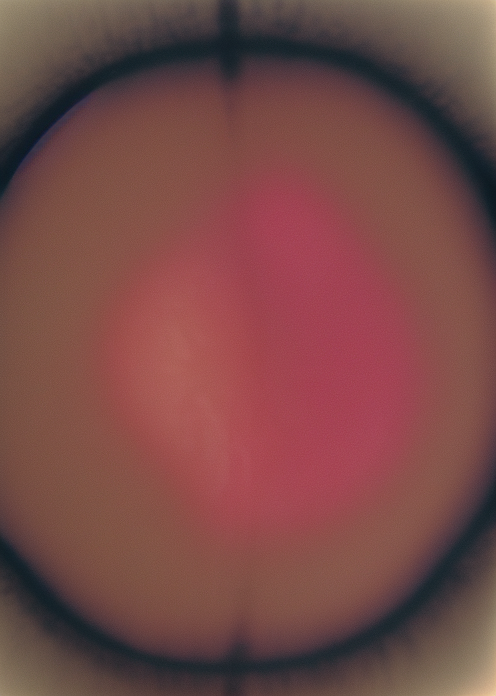 00025-4102247883